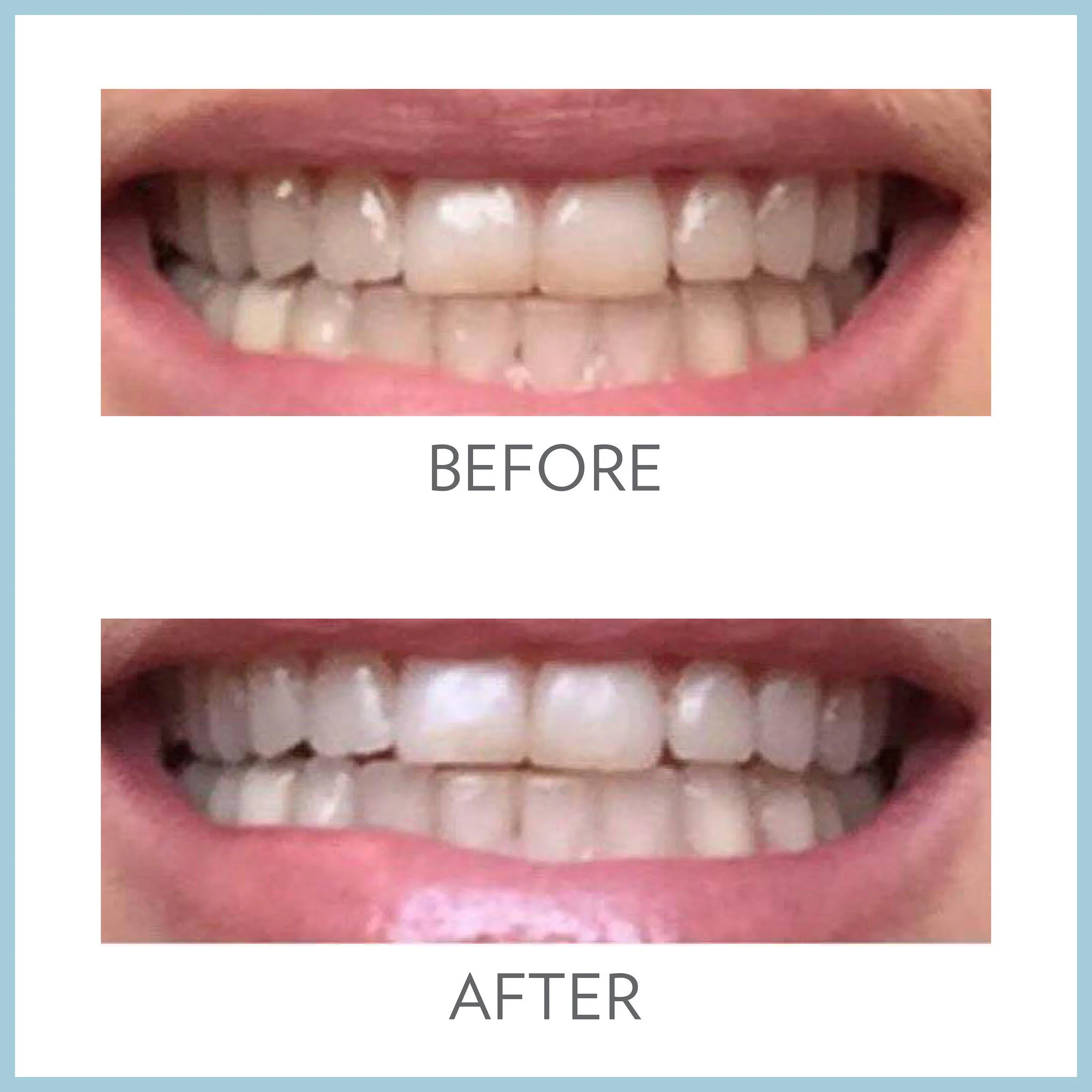 antes y despues ap24 ella